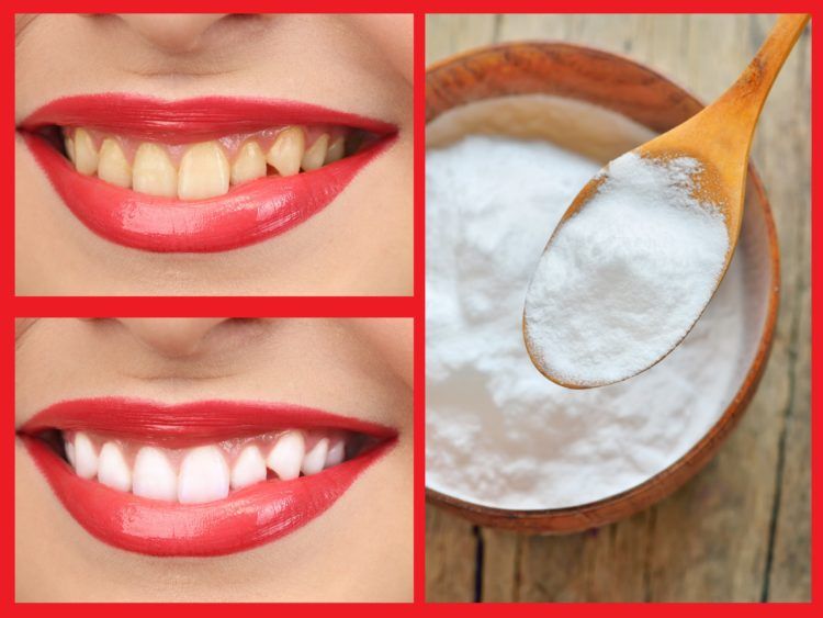 cmo blanquear los dientes con bicarbonato