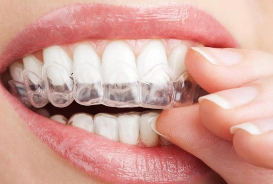 como blanquear los dientes en casa